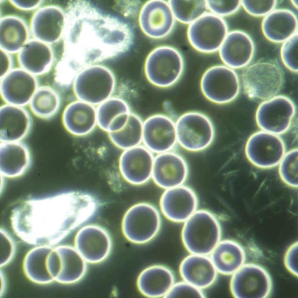 Live blood sample showingwhite blood cells after a session of PEMF therapy on CELLER8
